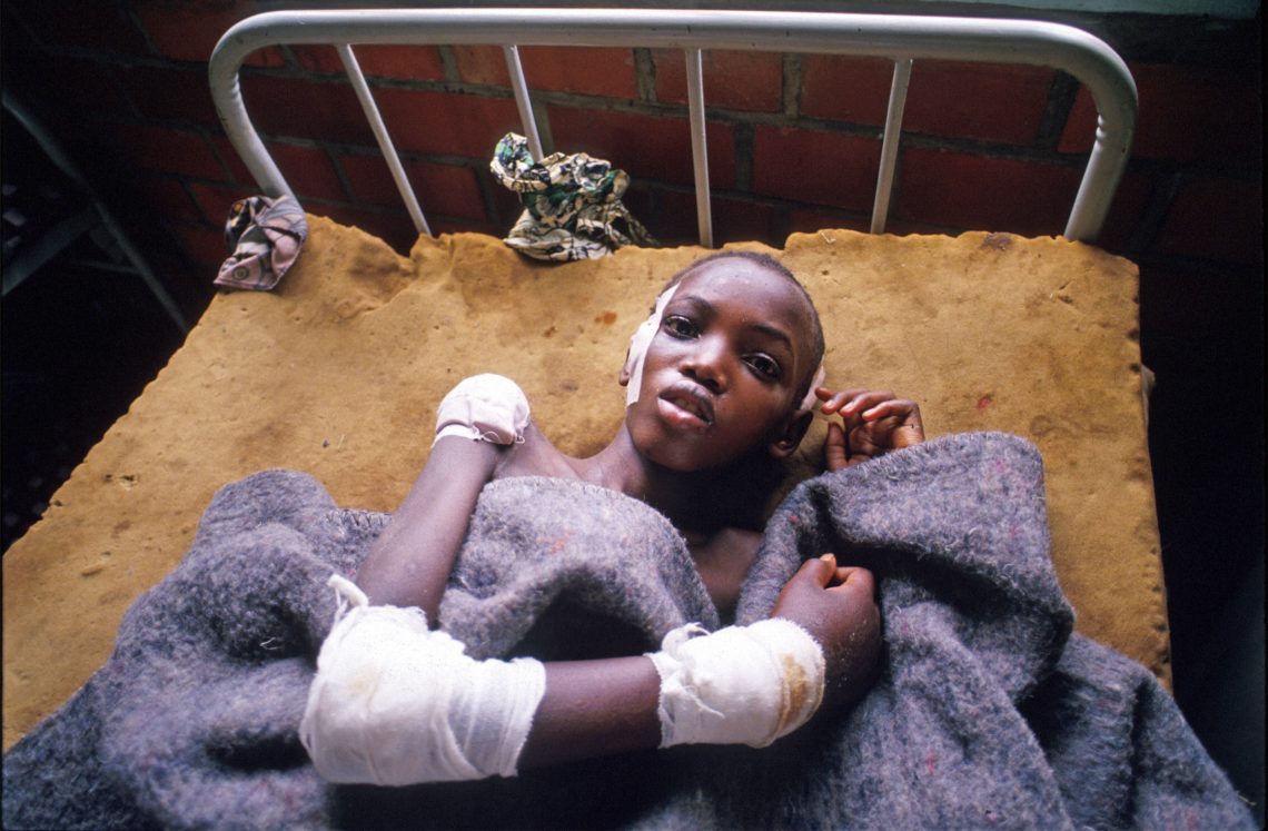 Eine Überlebende des Völkermords in Ruanda in einem Krankenhausbett, Mai 1994