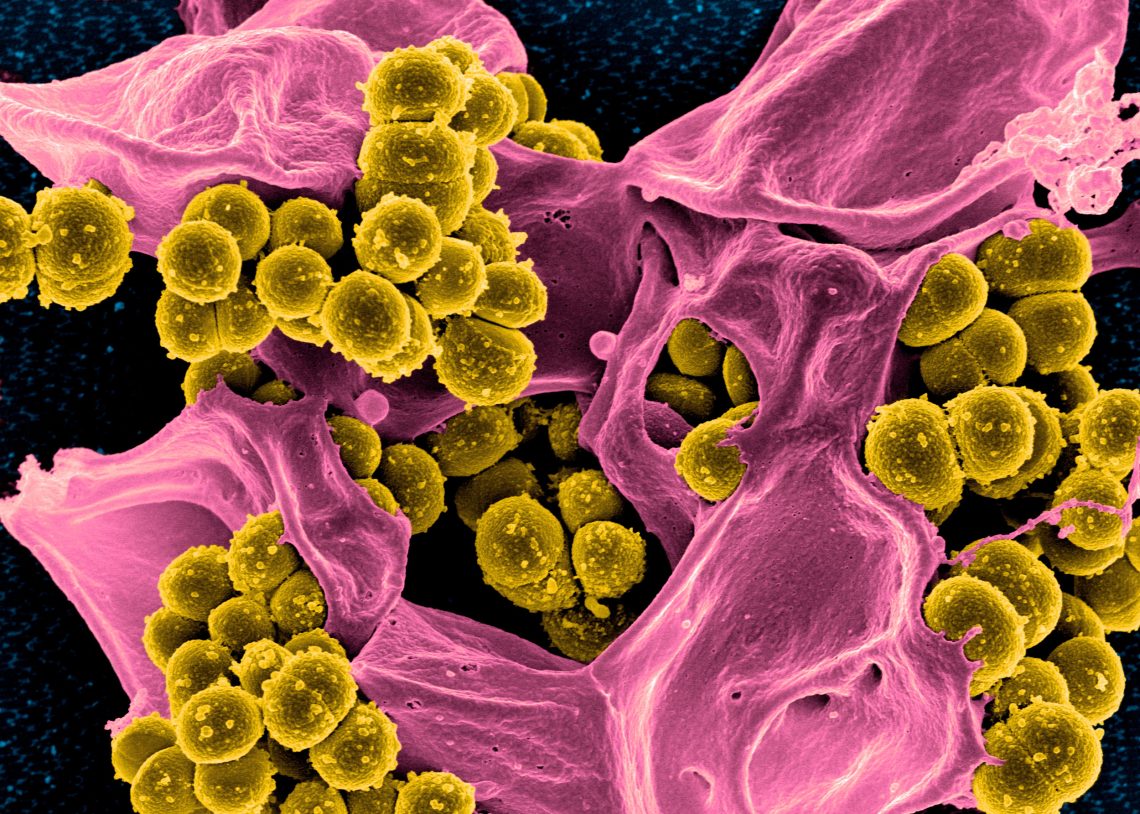 Mikroskopische Aufnahme eines Bakteriums. Es ist ein Keim, der gegen Antibiotika resistent ist.
